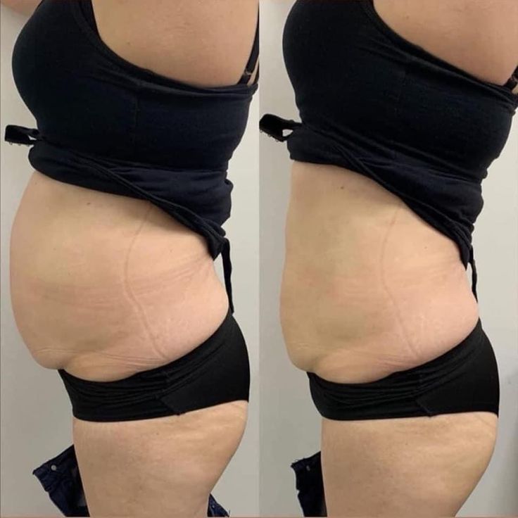 Cellushape 3